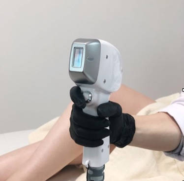 Epilation1